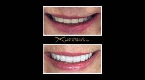 cosmetic dentistry in houston