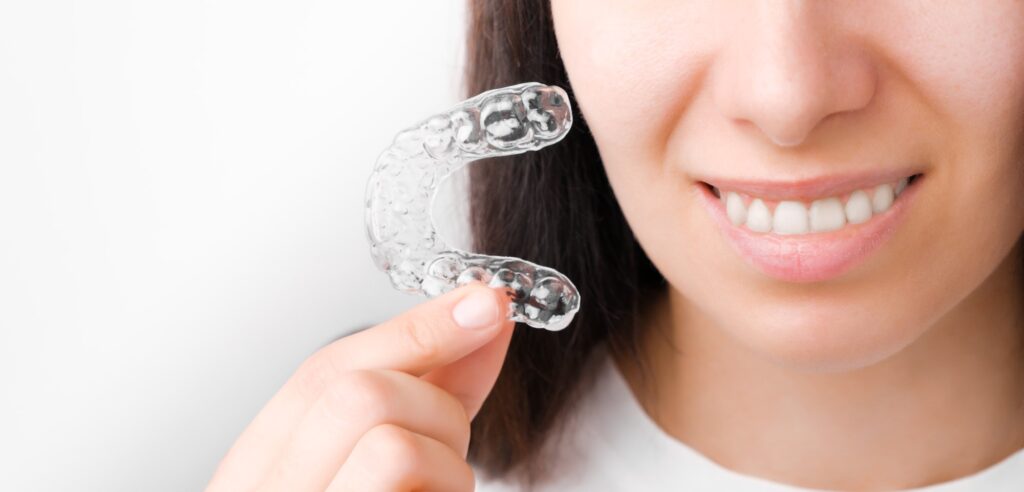 clear braces