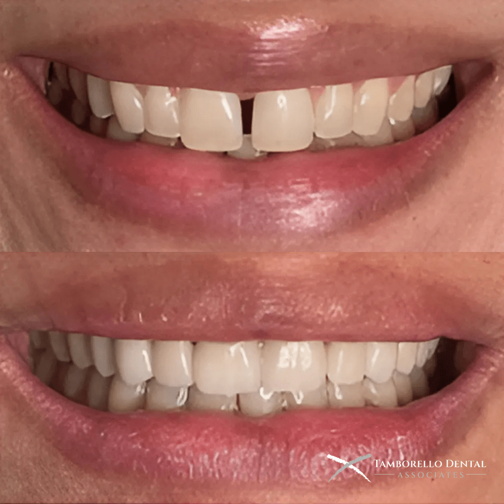 Smile Design By Dr. Holly